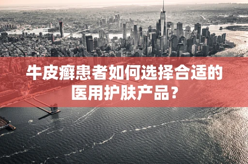 牛皮癣患者如何选择合适的医用护肤产品？
