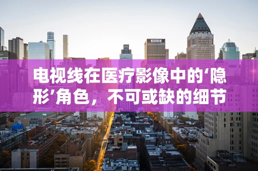 电视线在医疗影像中的‘隐形’角色，不可或缺的细节捕捉者？